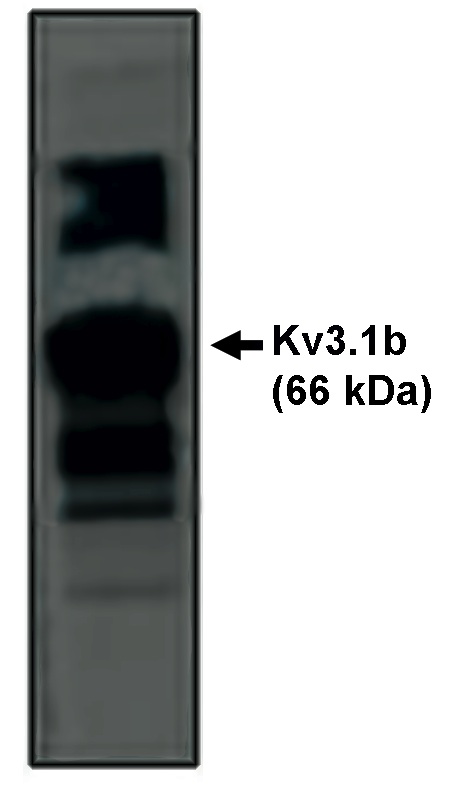 "
Western blot analysis using Kv3.1b antibody on rat brain lysate."